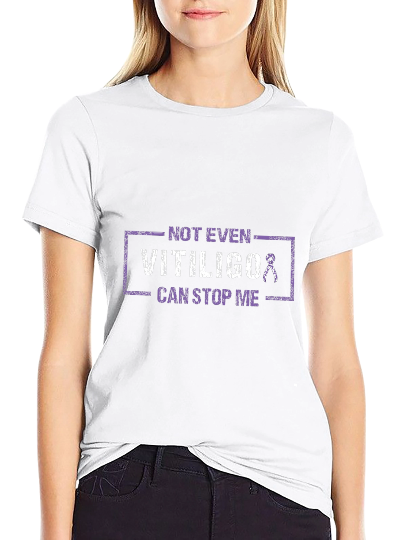 Vitiligo Awareness T-Shirt